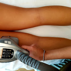 Velashape-II(1).jpg